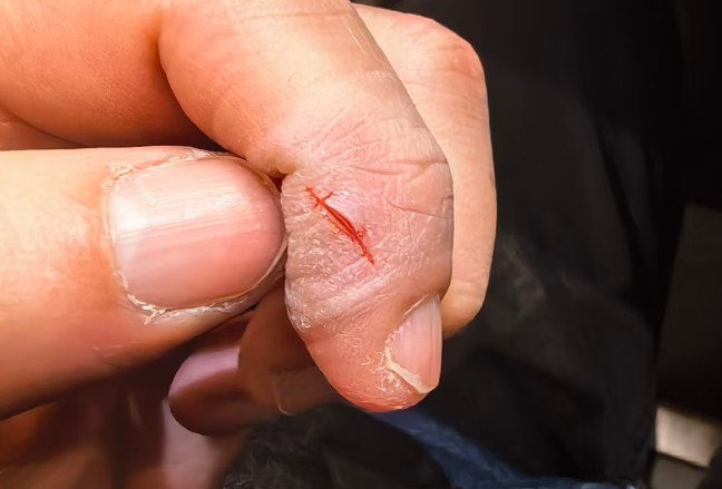 #随记 可能还是人到中年，身体的抵抗力变差了吧，每到秋冬季，手就会开裂，以前是从来没有过的！好像也没有什么好的治疗方面，唯一就是多涂点护手霜，再戴一次性手套！但是，这也不是个办法呀！via 老张随笔